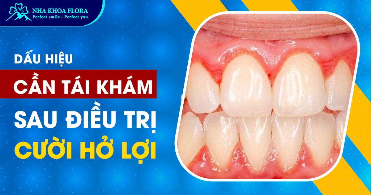 5 dấu hiệu cần tái khám ngay sau phẫu thuật hở lợi