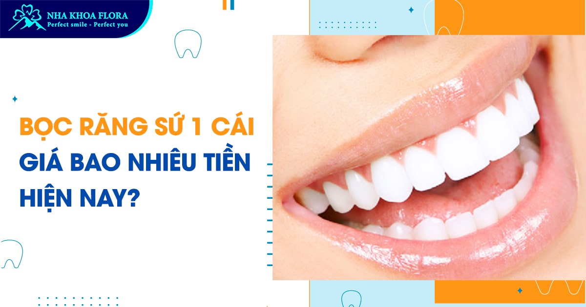 Bọc răng sứ 1 cái giá bao nhiêu tiền?
