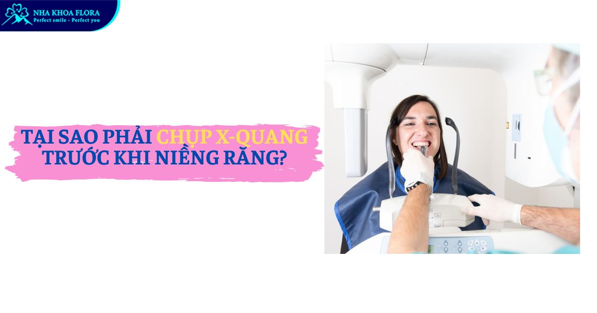 Tại sao phải chụp X-quang trước khi niềng răng?
