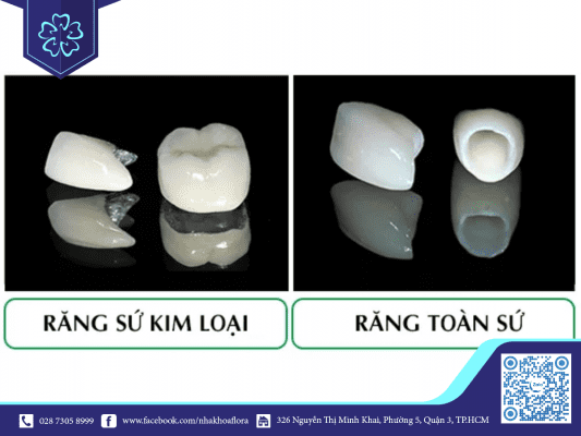 gia-boc-rang-su-mot-cai-bao-nhieu-phu-thuoc-vao-loai-mao-su Giá bọc răng sứ 1 cái bao nhiêu phụ thuộc vào loại mão sứ