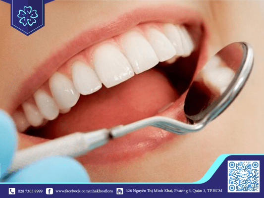 rang-cercon-co-do-dep-tu-nhien Răng Cercon có độ đẹp tự nhiên (ảnh minh họa)