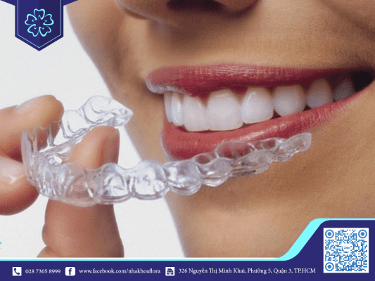 kinh-nghiem-nieng-rang-invisalign-phu-hop-voi-moi-lua-tuoi