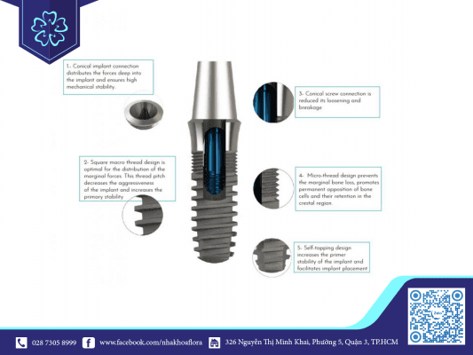 thiet-ke-rang-implant-cap-do-mo Thiết kế răng Implant cấp độ mô