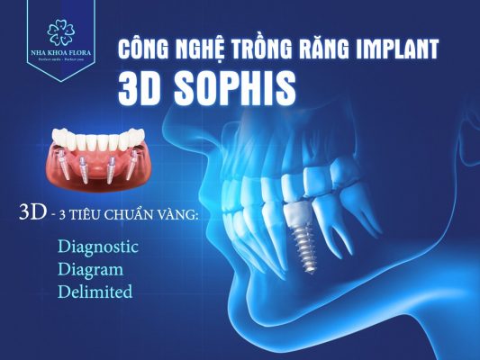 cong-nghe-trong-rang-3d-sophis-doc-quyen-tai-nha-khoa-flora Công nghệ trồng răng 3D Sophis độc quyền tại nha khoa Flora