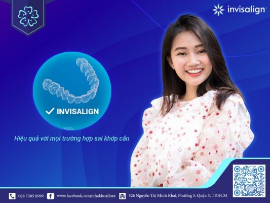 neing-rang-uy-tin-tai-flora Niềng răng uy tín tại Flora