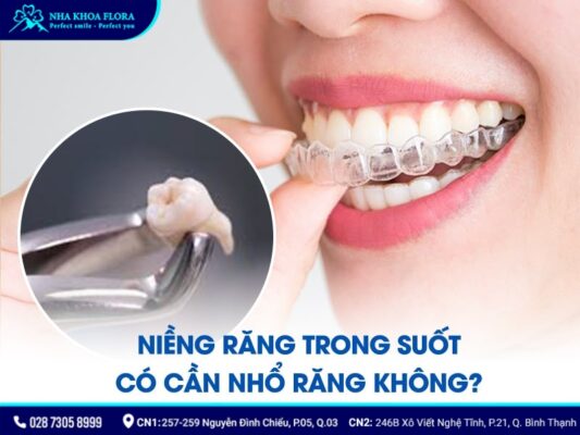 niềng răng trong suốt có phải nhổ răng không - ảnh 1 niềng răng trong suốt có phải nhổ răng không - ảnh 1