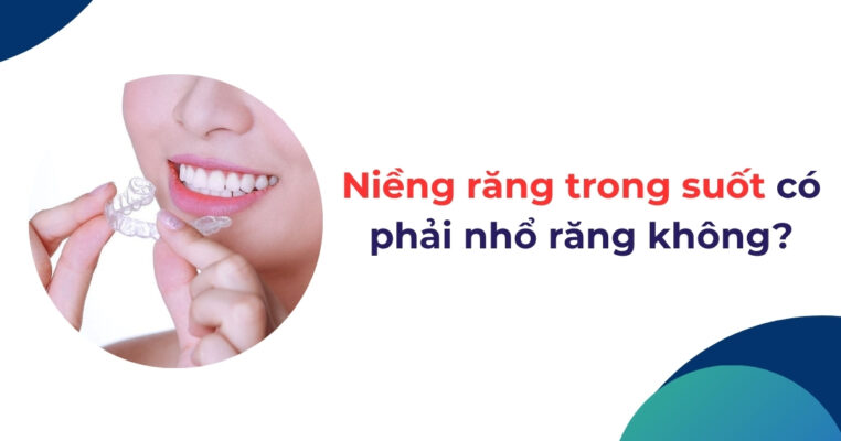 niềng răng trong suốt có phải nhổ răng không