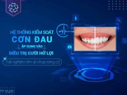 Hệ thống kiểm soát cơn đau trong phẫu thuật cười hở lợi