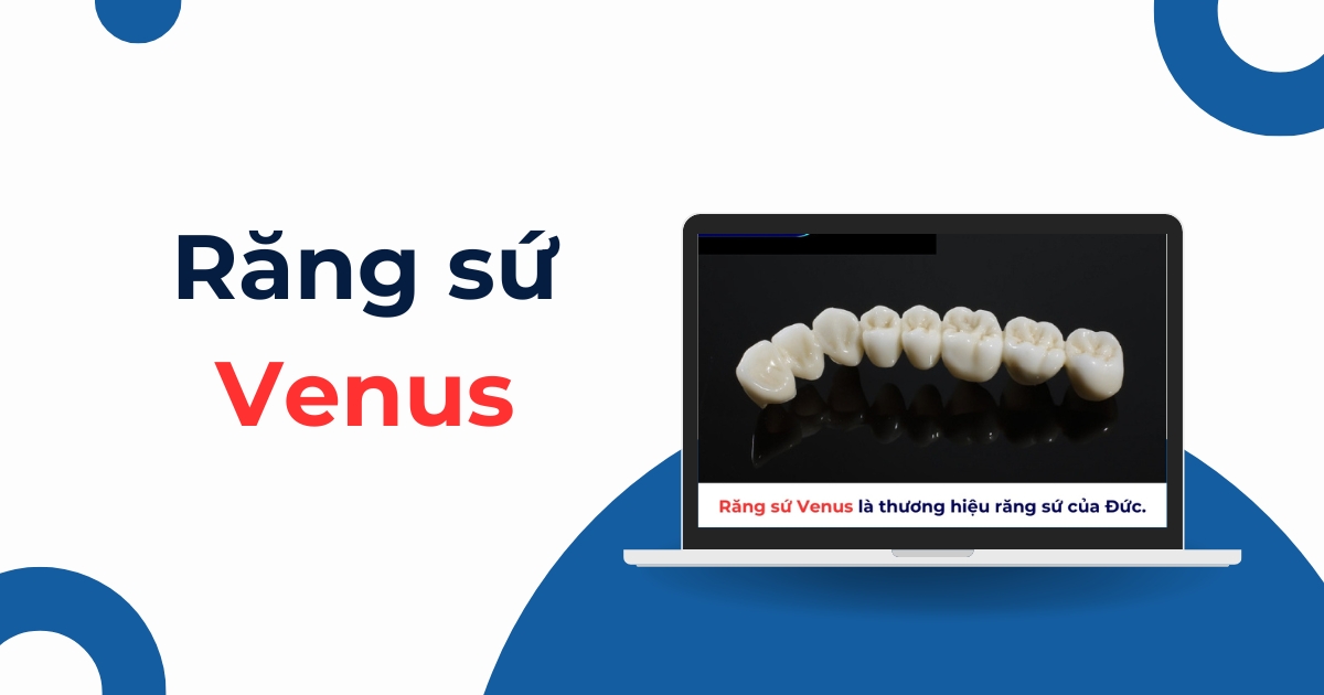 Răng sứ Venus của hãng nào? Có tốt không? Giá bao nhiêu?