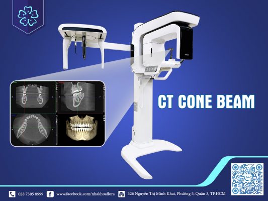 may-ct-cone-beam-ho-tro-boc-rang Máy CT Cone Beam hỗ trợ bọc răng