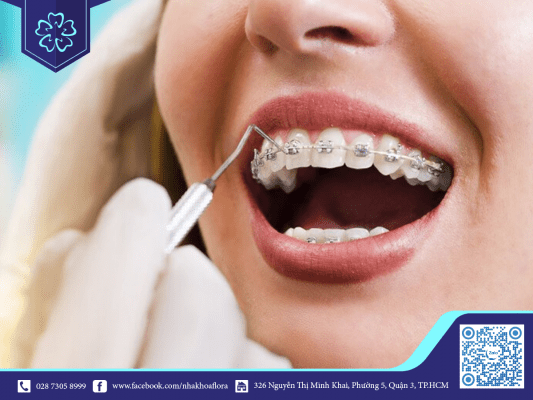x-quang-nieng-rang-giup-dam-bao-ket-qua-nieng X quang niềng răng giúp đảm bảo kết quả niềng