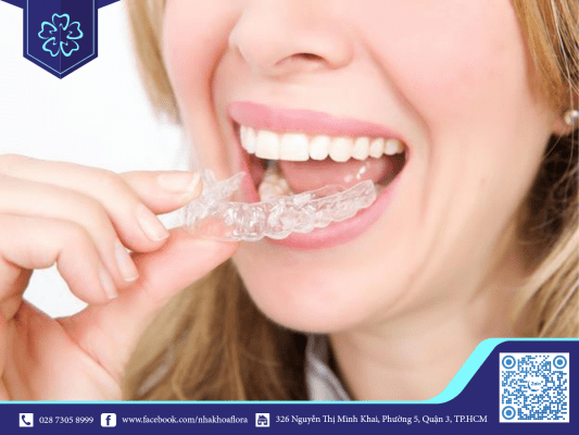 4 DẤU HIỆU KHIẾN BẠN CÓ THỂ CẦN ĐEO NIỀNG RĂNG VÀO BAN ĐÊM 4
