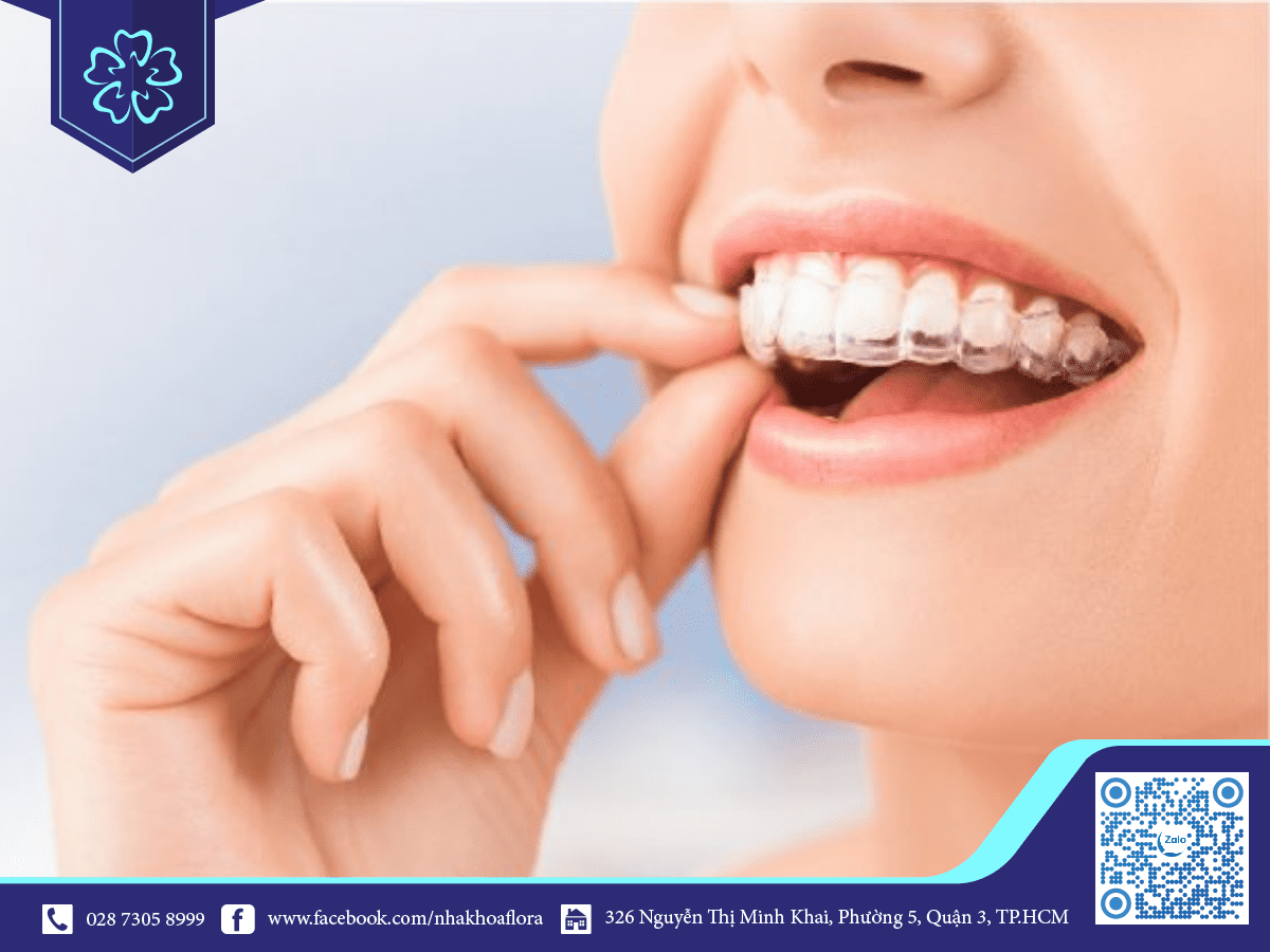 How Many Hours A Day Do You Need To Wear Invisalign Braces? Nha Khoa