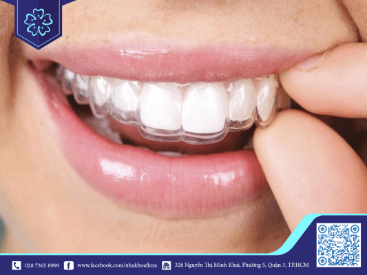 Niềng răng invisalign có thay đổi giọng nói của tôi? 5