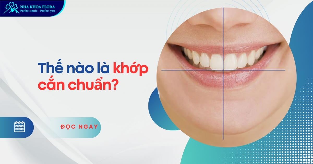 Khớp cắn chuẩn: Khái niệm, Lợi ích & Cách sở hữu