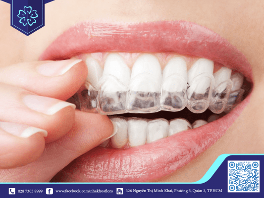 Mọc răng khi đang niềng phải làm sao? 1