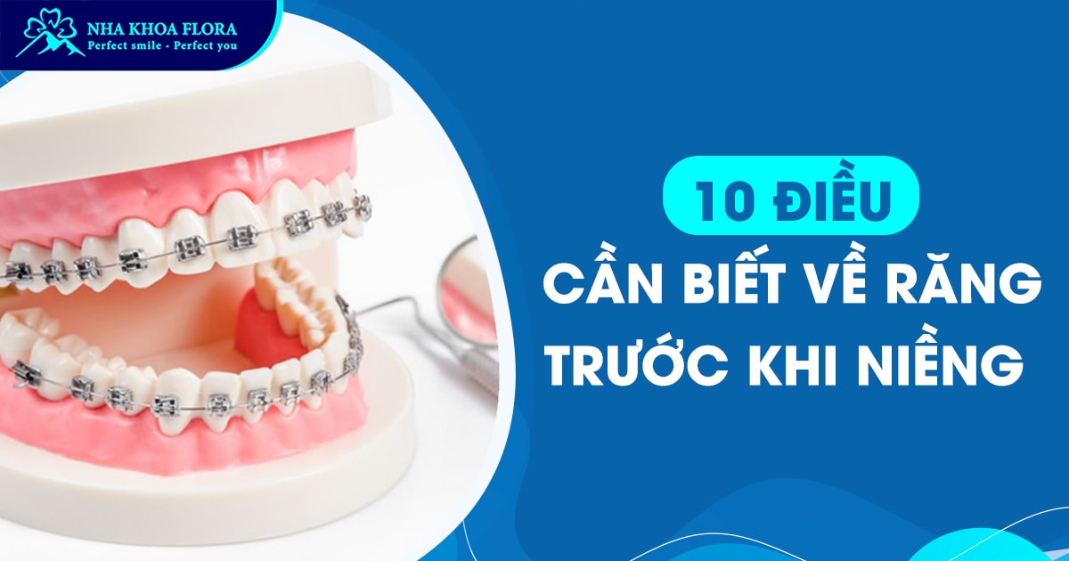 10 điều bạn chưa biết về răng của mình trước khi niềng răng