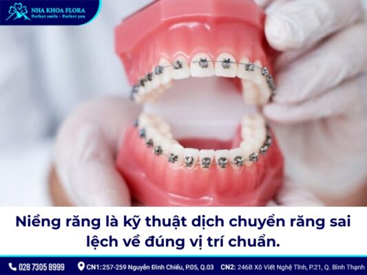 Niềng răng có làm răng yếu đi? - ảnh 1 Niềng răng có làm răng yếu đi? - ảnh 1