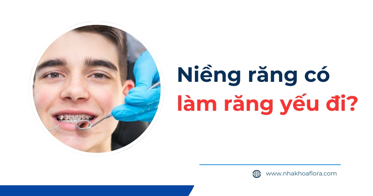 Niềng răng có làm răng yếu đi? Cách phòng tránh hiệu quả