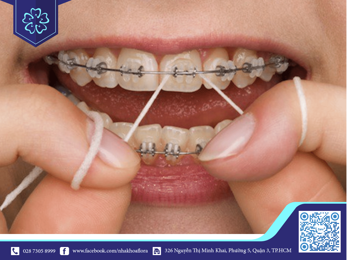 Common Problems With Braces