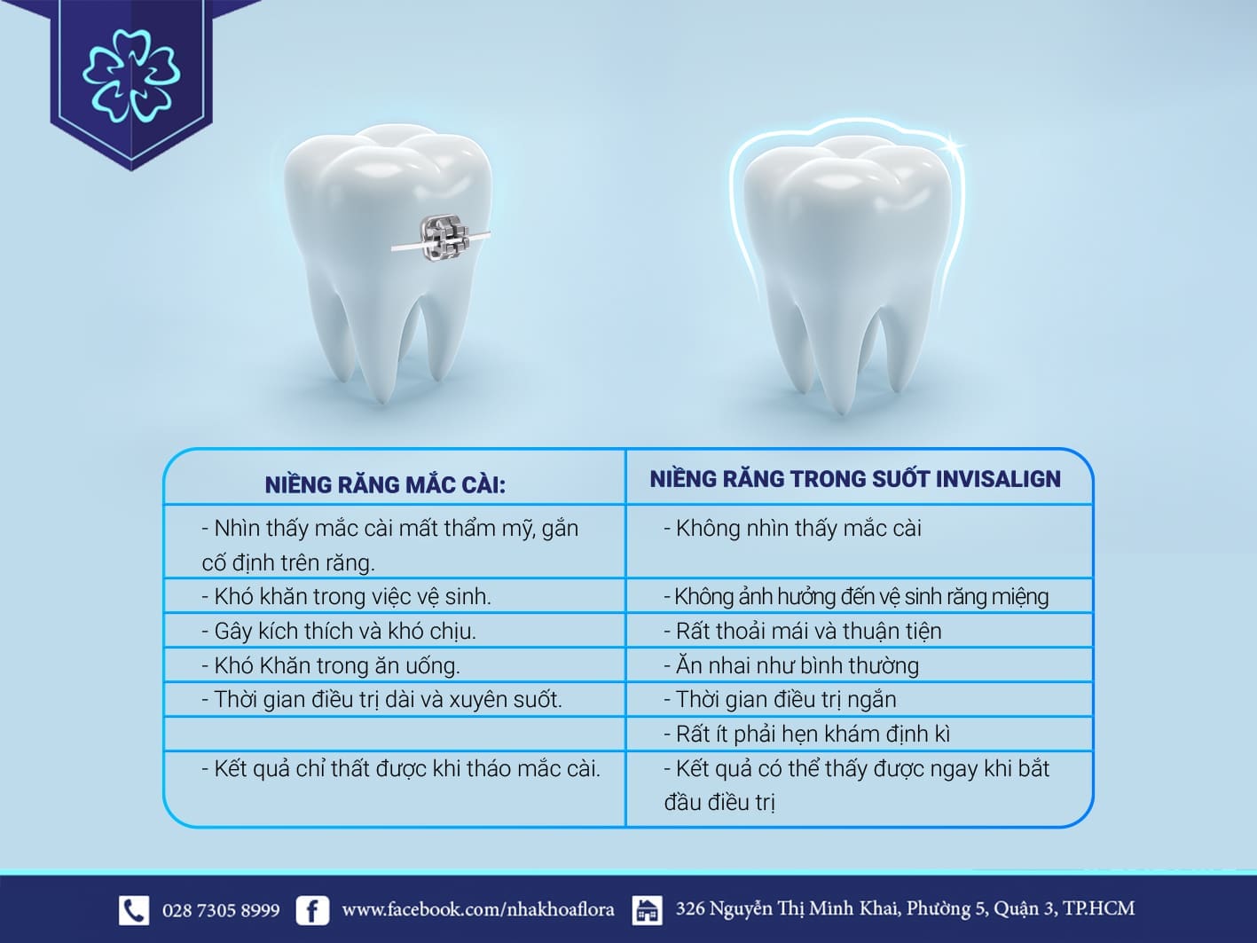 So sánh các loại niềng răng