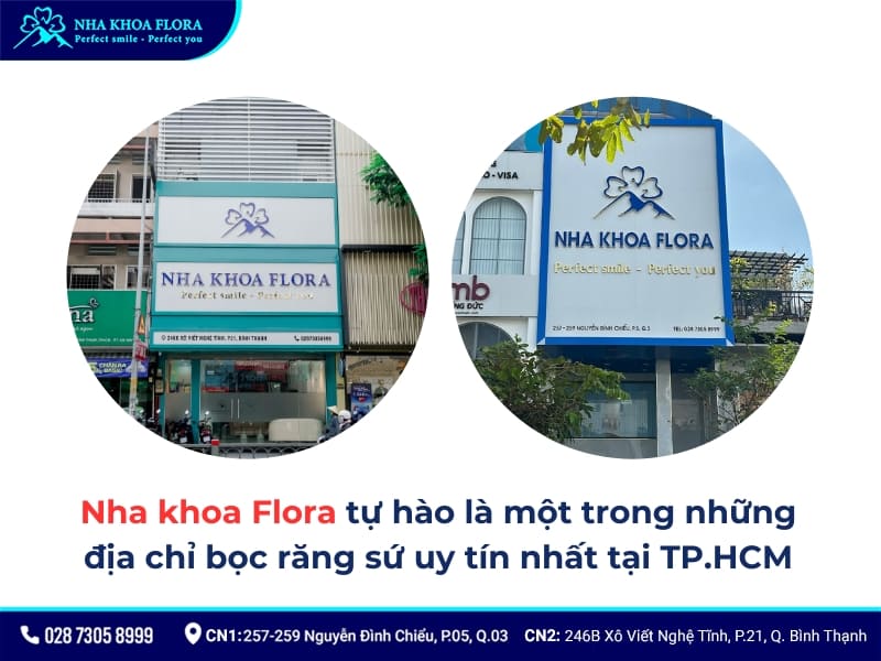 bọc răng sứ ở đâu tốt nhất