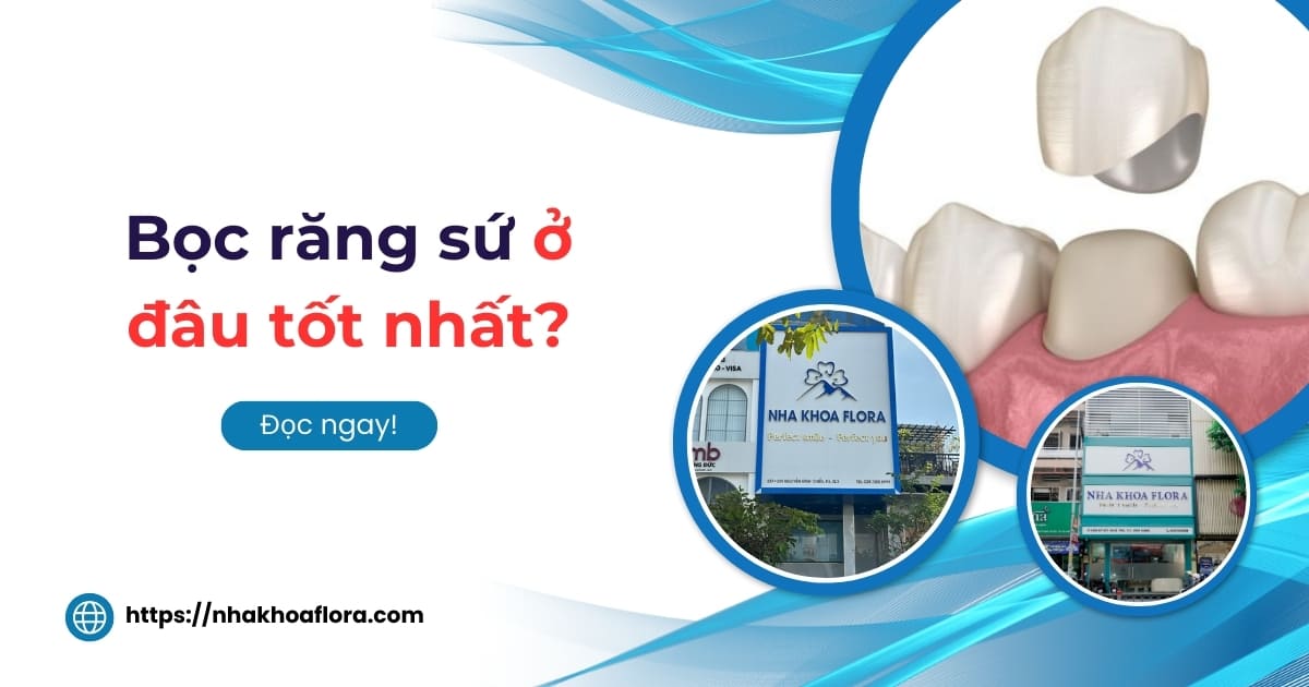 Bọc răng sứ ở đâu tốt nhất và có bảo hành dịch vụ uy tín?