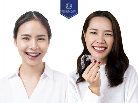 TOP 10 NHA KHOA TẠI TP.HCM CÓ DỊCH VỤ NIỀNG RĂNG TỐT 5