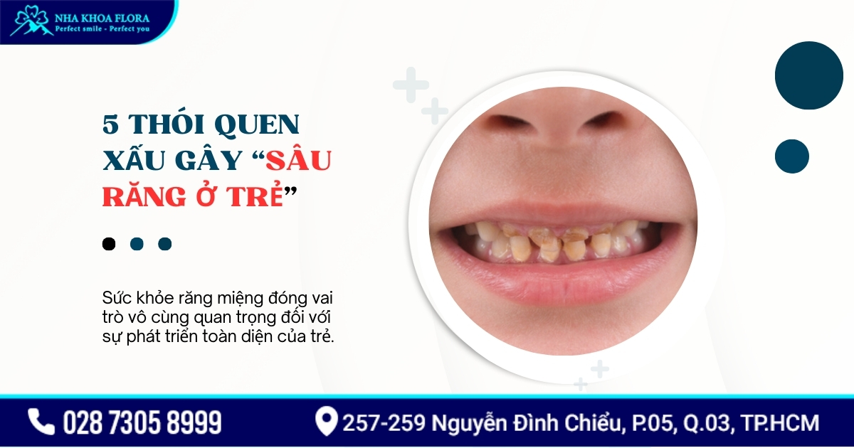 5 thói quen xấu gây sâu răng ở trẻ thường gặp