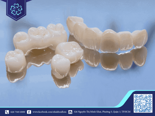THUẬT NGỮ BỌC RĂNG SỨ TRONG NHA KHOA 1
