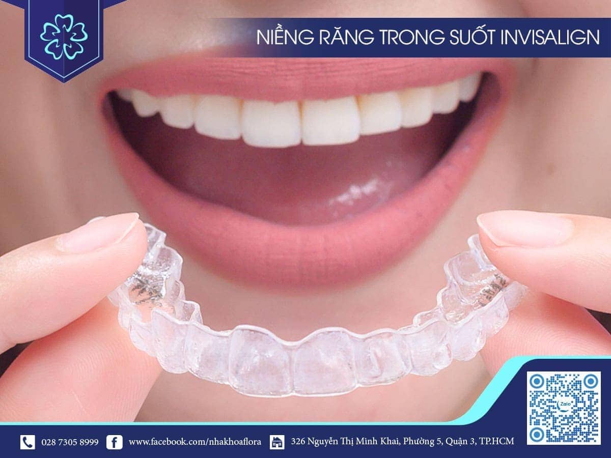 hàm trong suốt invisalign