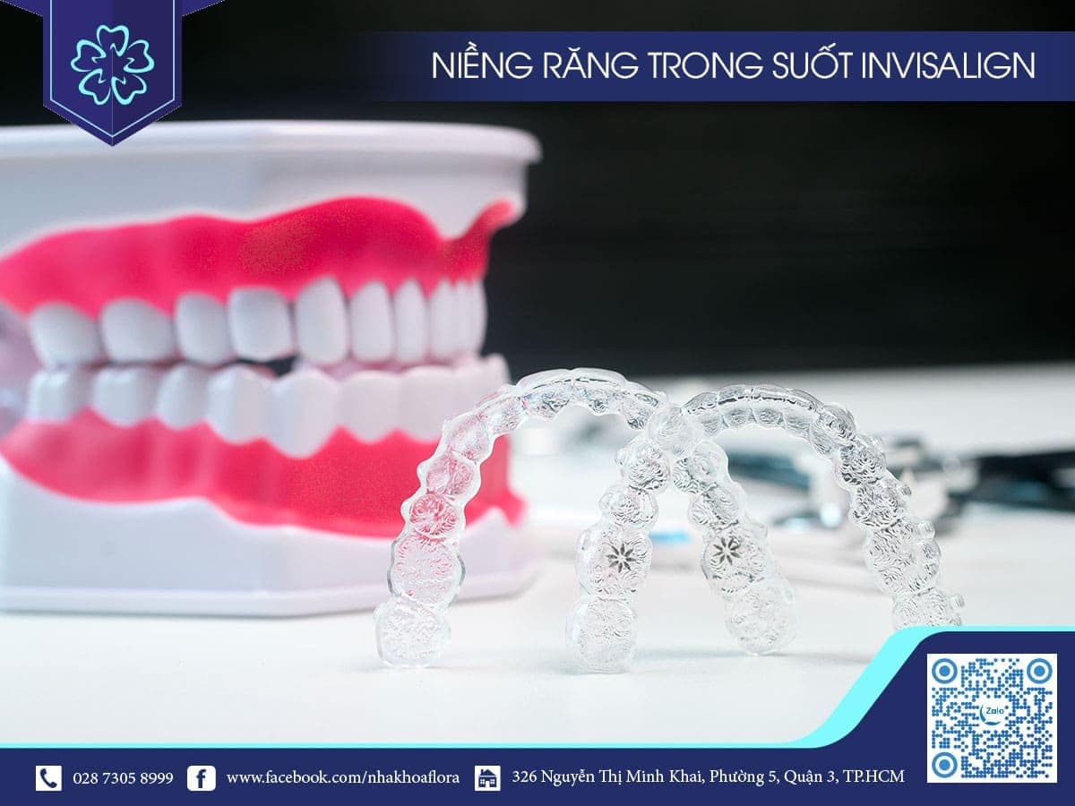 phương pháp niềng răng trong suốt invisalign