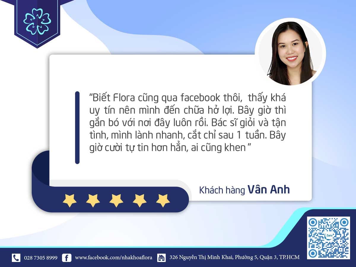 review sau chữa cười hở lợi - khách hàng vân anh