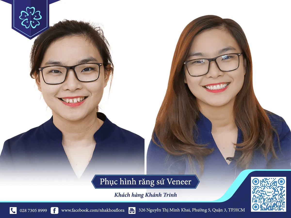 KHÁCH HÀNG BỌC RĂNG SỨ