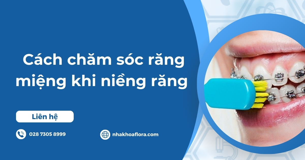 Cách chăm sóc răng miệng khi niềng răng khoa học, hiệu quả