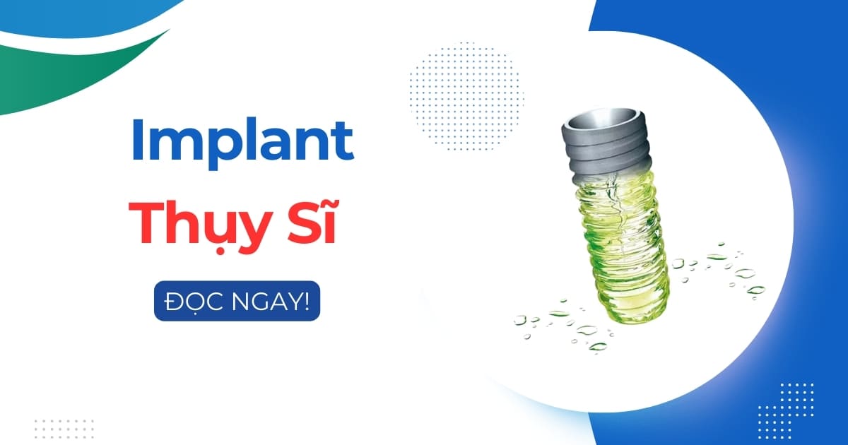 Trụ Implant Thụy Sĩ có tốt hay không? Giá bao nhiêu tiền?