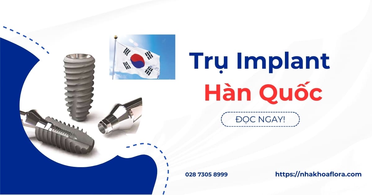 Trụ Implant Hàn Quốc có tốt không? Ưu, nhược điểm và giá cả