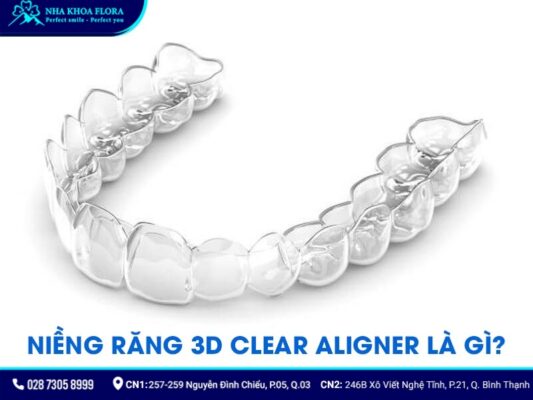 niềng răng không mắc cài 3d clear - ảnh 1 niềng răng không mắc cài 3d clear - ảnh 1