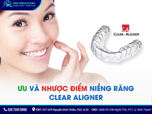 niềng răng không mắc cài 3d clear - ảnh 3 niềng răng không mắc cài 3d clear - ảnh 3