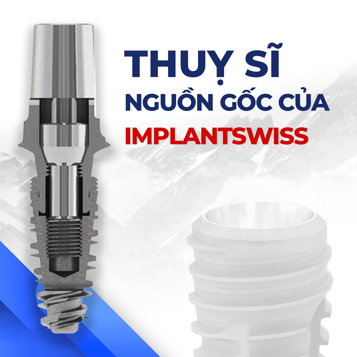 Trụ Implantswiss Thụy Sĩ - Chất lượng trụ Implant hàng đầu thế giới