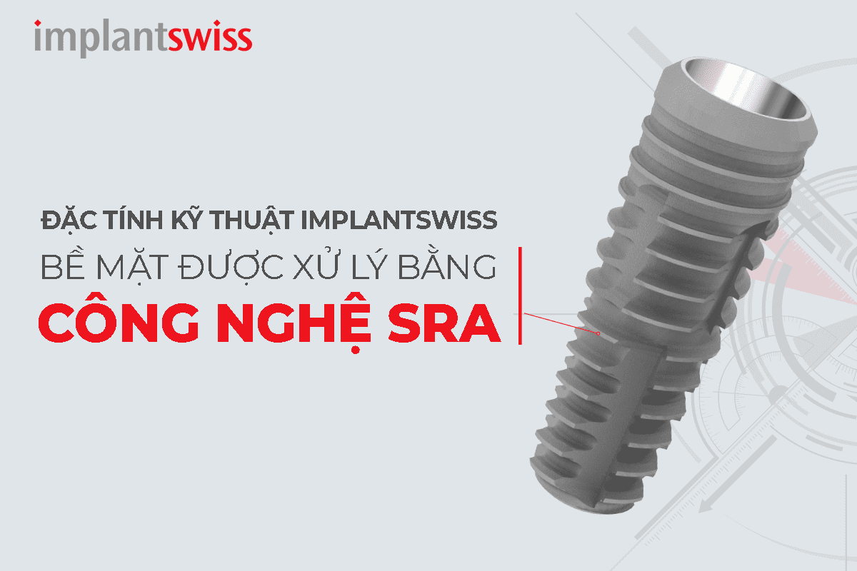 Bề mặt SRA là một trong những ưu điểm giúp Implantswiss được các chuyên gia đánh giá cao