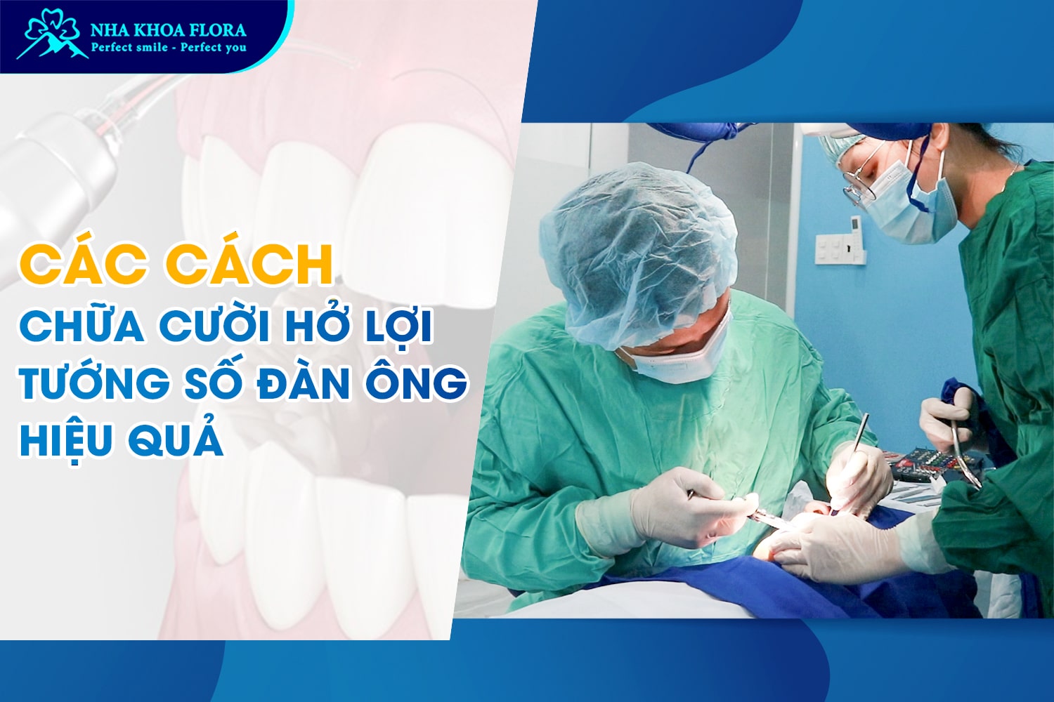 cười hở lợi tướng số đàn ông