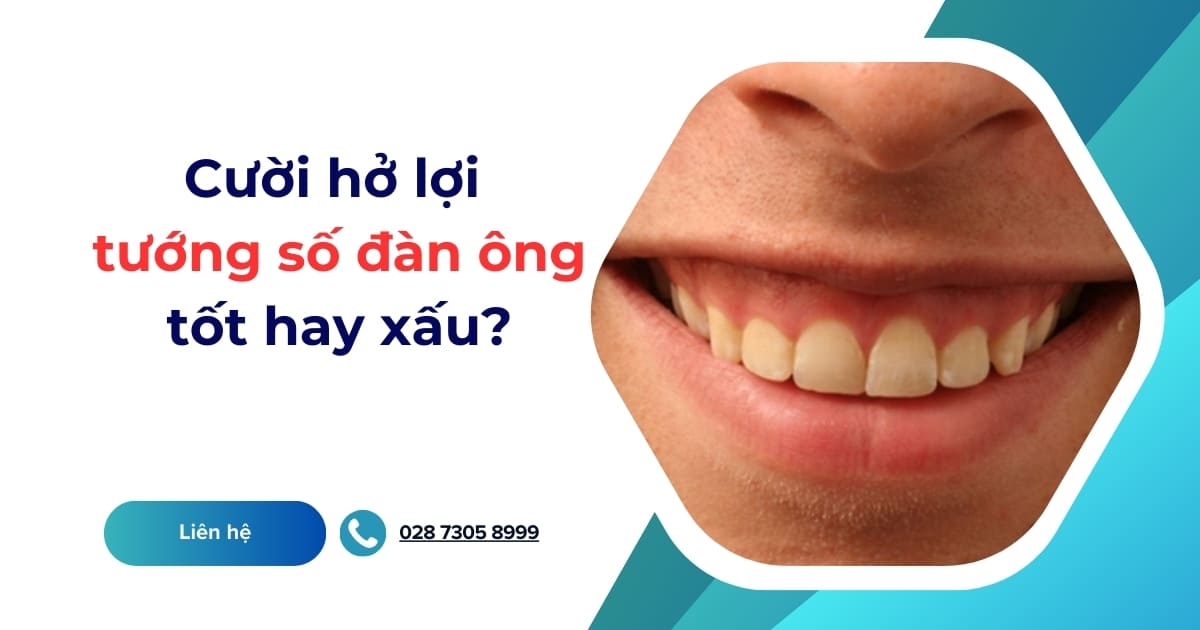 Cười hở lợi tướng số đàn ông tốt hay xấu? Sướng hay khổ?
