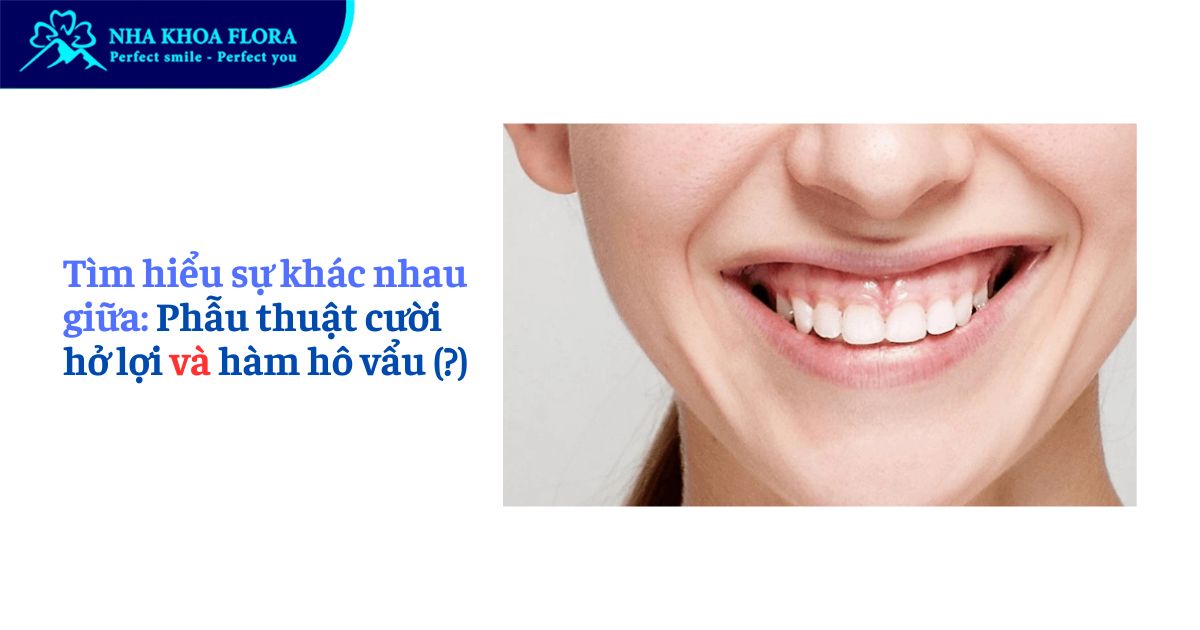 Sự khác nhau giữa phẫu thuật cười hở lợi và hàm hô vẩu