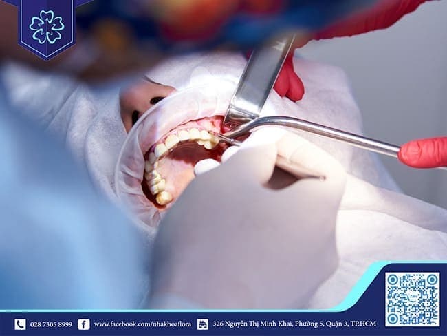 Bệnh nhân sẽ được thăm khám trước khi trồng răng (ảnh minh họa) Bác sĩ tiến hành cắm trụ Implant straumann