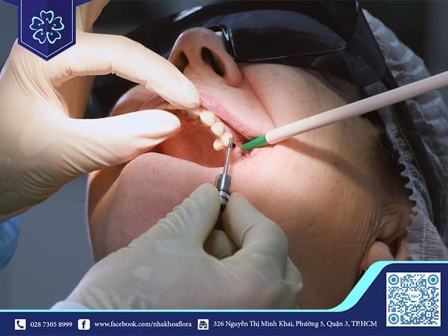 Is dental implants dangerous for the elderly?