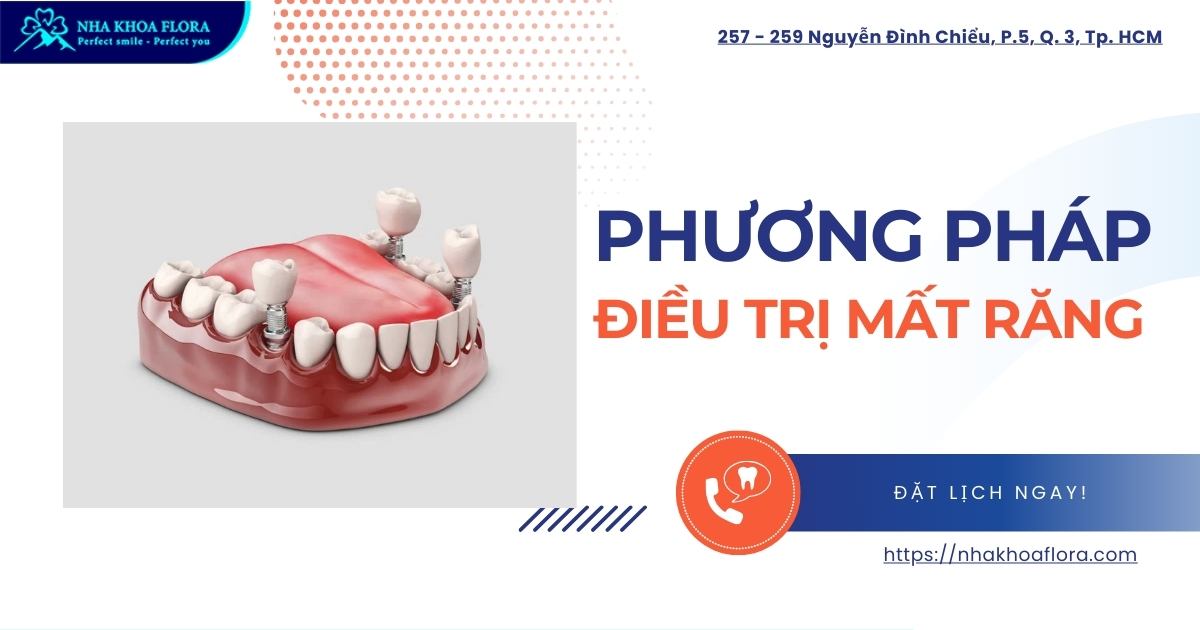 So sánh các phương pháp điều trị mất răng hiện nay
