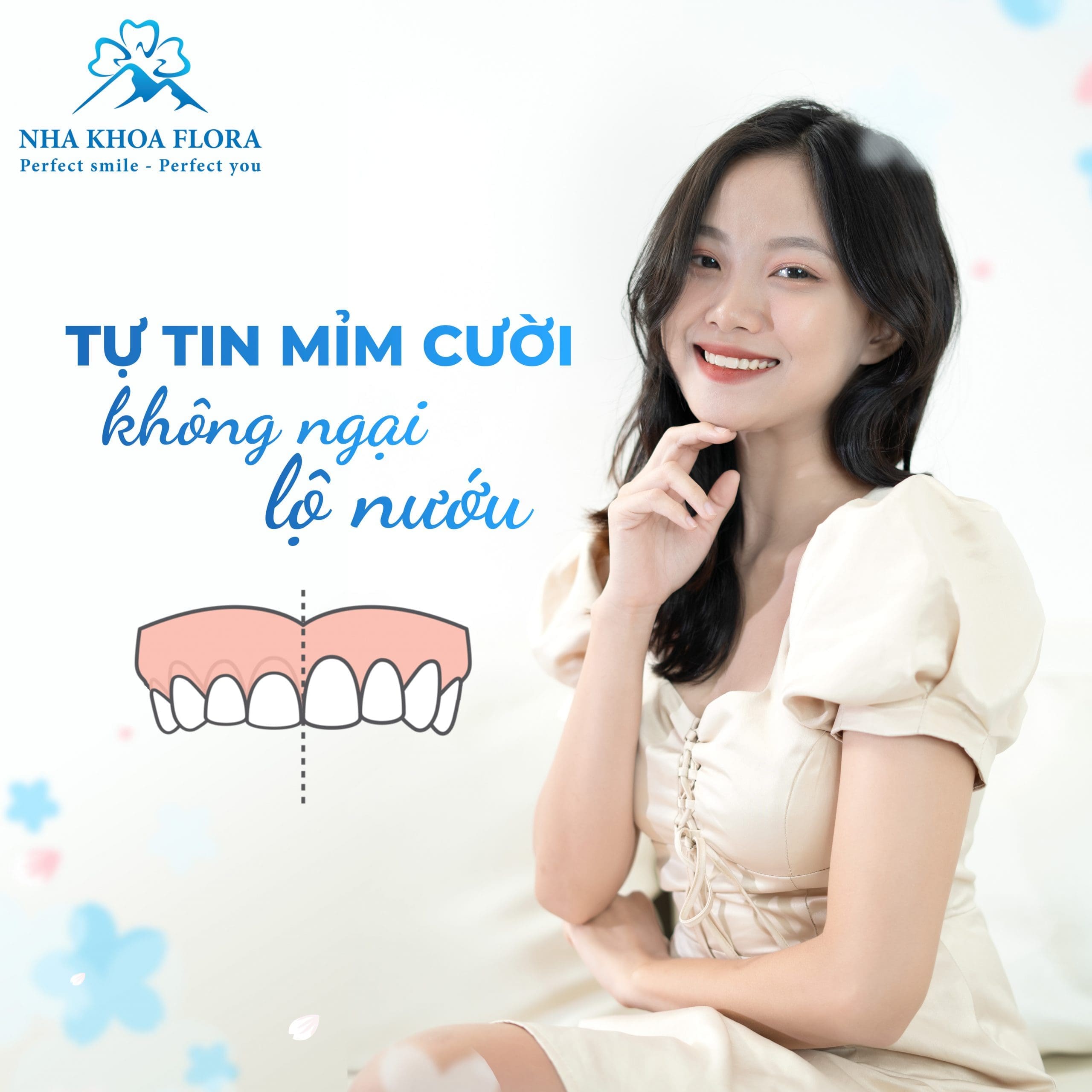 Chữa cười hở lợi ở đâu tốt nhất Chữa cười hở lợi ở đâu tốt nhất