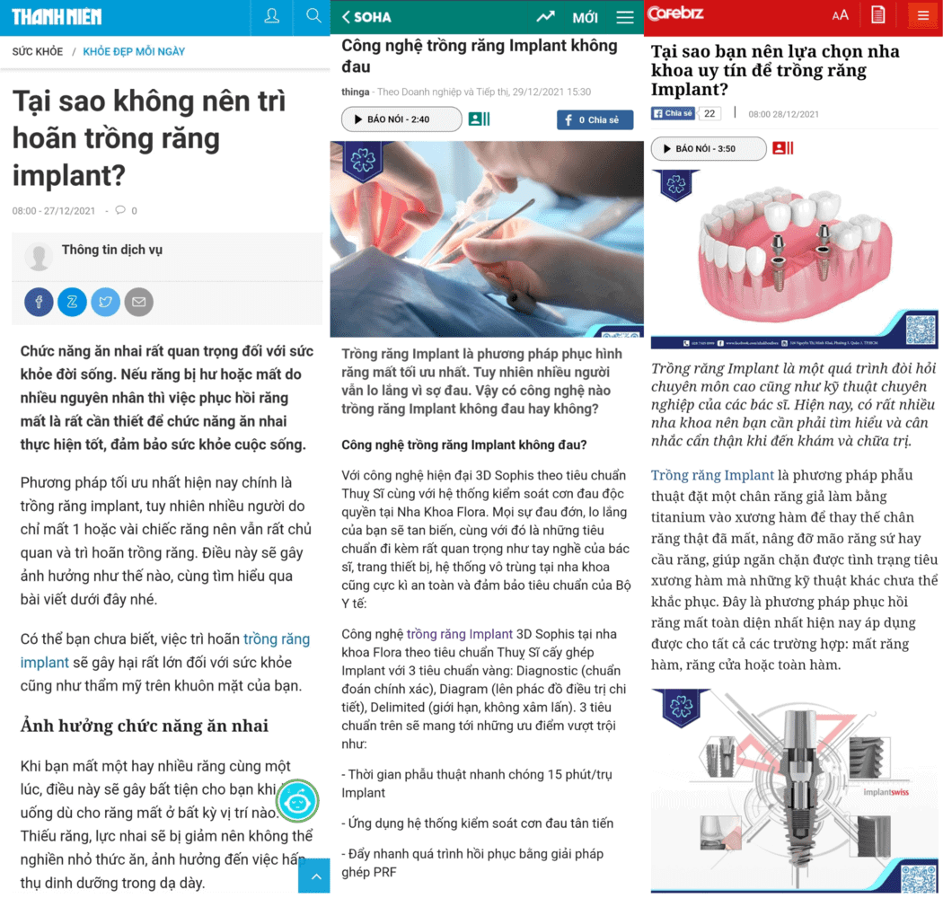 báo chí viết về dịch vụ trồng răng implant tại nha khoa flora