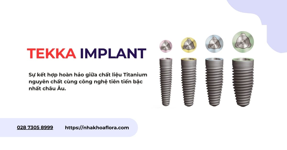Tekka Implant của nước nào? Có tốt không? Giá bao nhiêu?
